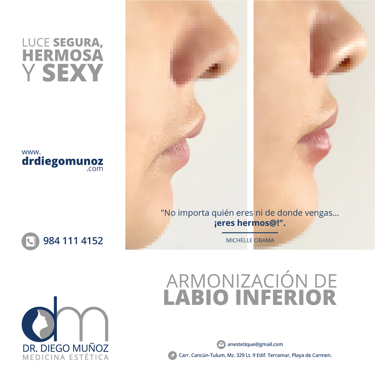 armonizacion de labios